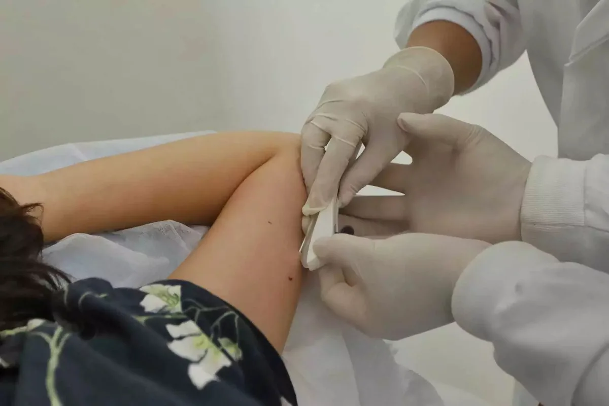 Portaria eleva idade mínima para registrar implante contraceptivo subdérmico