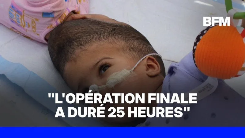 États-Unis: des médecins séparent avec succès des jumelles soudées par la tête
