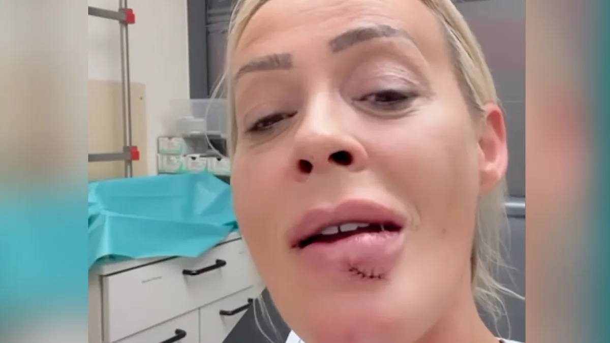 Unfallchirurg muss Lippe nähen - Blut, Schmerzen! Cora Schumacher in Notaufnahme