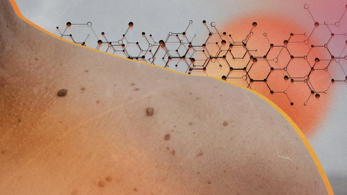 Pour la première fois, un vaccin contre le cancer à base d’ARNm franchit une étape décisive