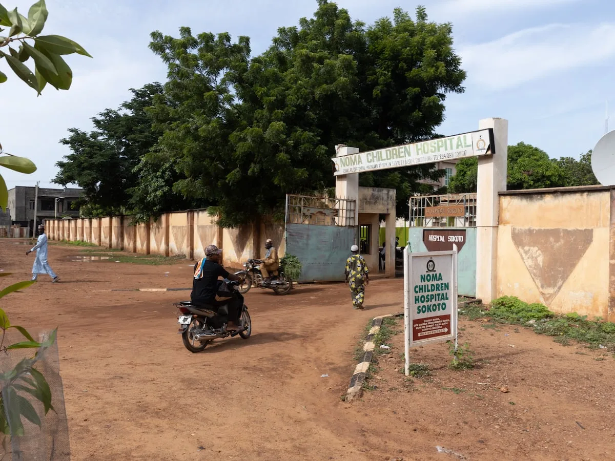 Free operations give hope to children with deadly noma disease in Nigeria