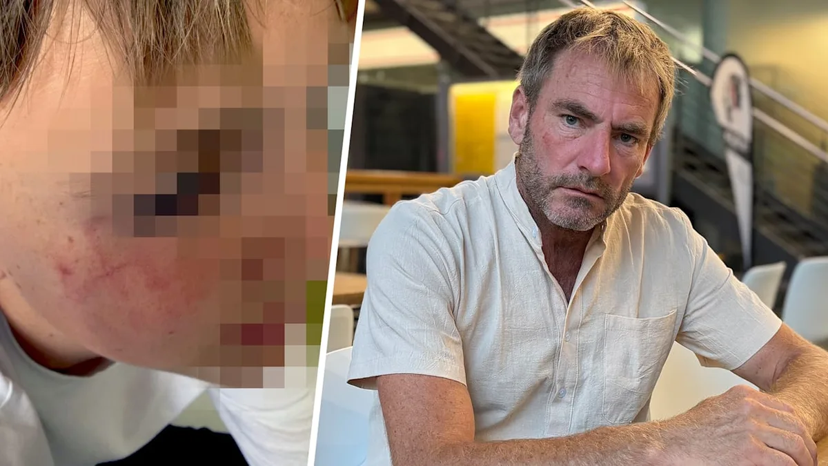 Attacke auf dem Bahnhof in Freiburg - Mann wollte meinem Sohn (14) das Auge ausreißen