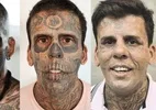 'Homem mais tatuado do Brasil' revela diagnóstico de câncer na bexiga