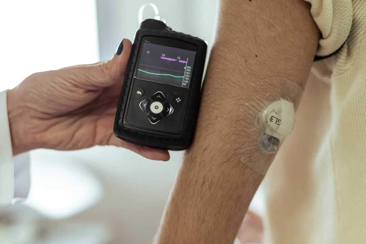 Diabetes tipo 2 avança entre jovens, especialmente entre mulheres