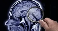 “Mapa” do autismo pode levar ao desenvolvimento de terapias direcionadas