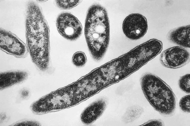 Toronto Public Health investigating legionnaires’ disease outbreak near downtown core