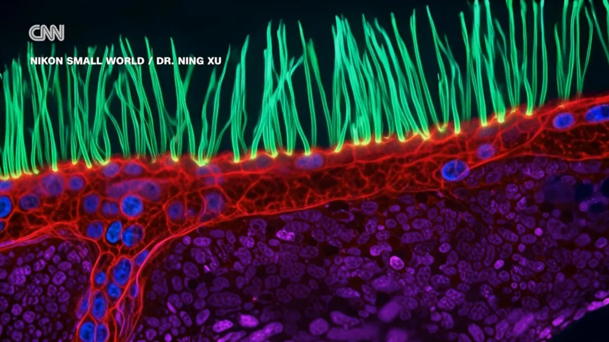 Contest-Winning Microscope Video Thrown Out for Using Generative AI