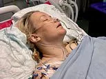 Hairdresser, 42, with suspected endometriosis was found to have ruptured tumour that required NINE organs be removed in the 'mother of all surgeries'