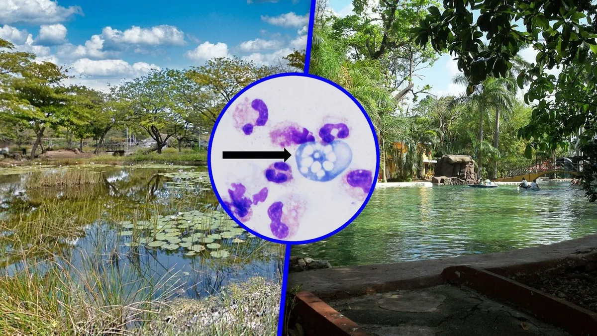Detectan ameba ‘comecerebros’ en seis lagos artificiales de Mérida; prohíben contacto con el agua