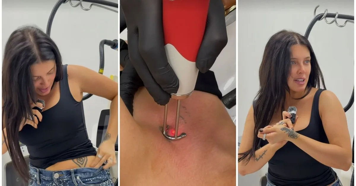 "Borrando el pasado": los insólitos tatuajes que Sofía Gonet decidió remover de su piel