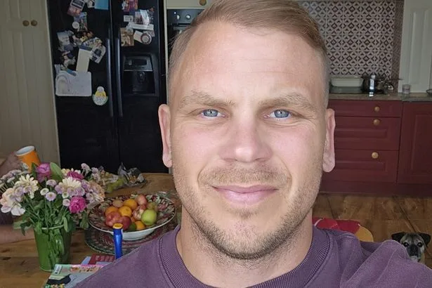 Man's eyes turned yellow at 25 after years of downing cider, vodka and hand gel