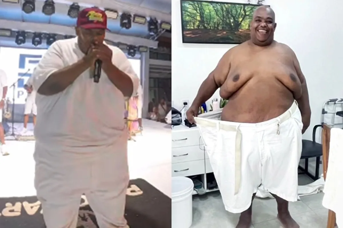 Cantor do Pagodart perde 108 kg e almeja voltar aos palcos após bariátrica