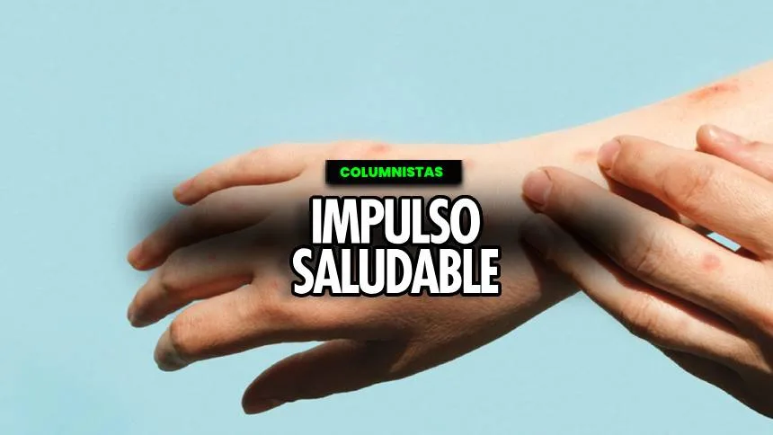 Alergia al frío: ¿Mito o realidad?