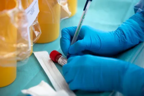 Researchers feel the strain as US funding dries up