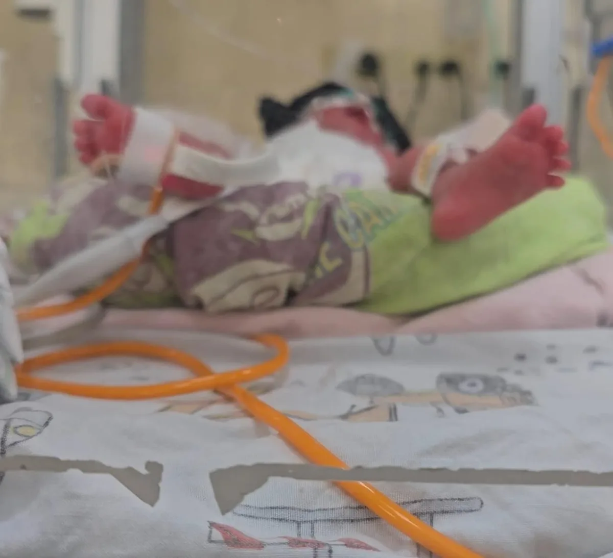 Tosferina deja tres nuevas muertes en Honduras y eleva a 22 los fallecidos en 2026