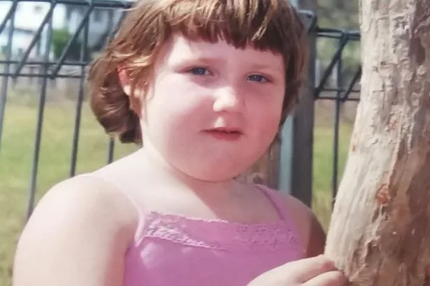 ‘I weighed 14st aged nine - losing 15st showed the real battle was after the weight came off'