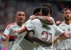 Jardim exalta elenco do Flamengo em meio a desfalques: 'Não somos só 11'