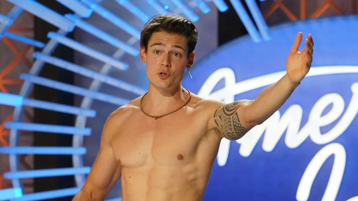 Viral ‘American Idol’ Star Performs Just 3 Days After Hair Transplant