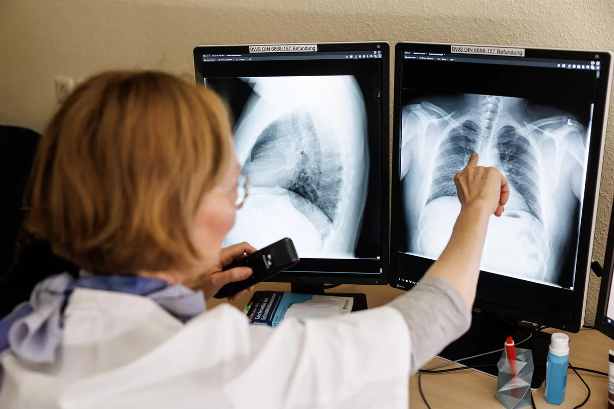 La Junta confirma tuberculosis en dos trabajadores de una explotación en Segovia, uno de los cuales ha fallecido