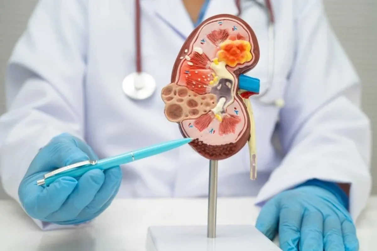 Un estudio alerta del avance de la enfermedad renal crónica entre las mujeres