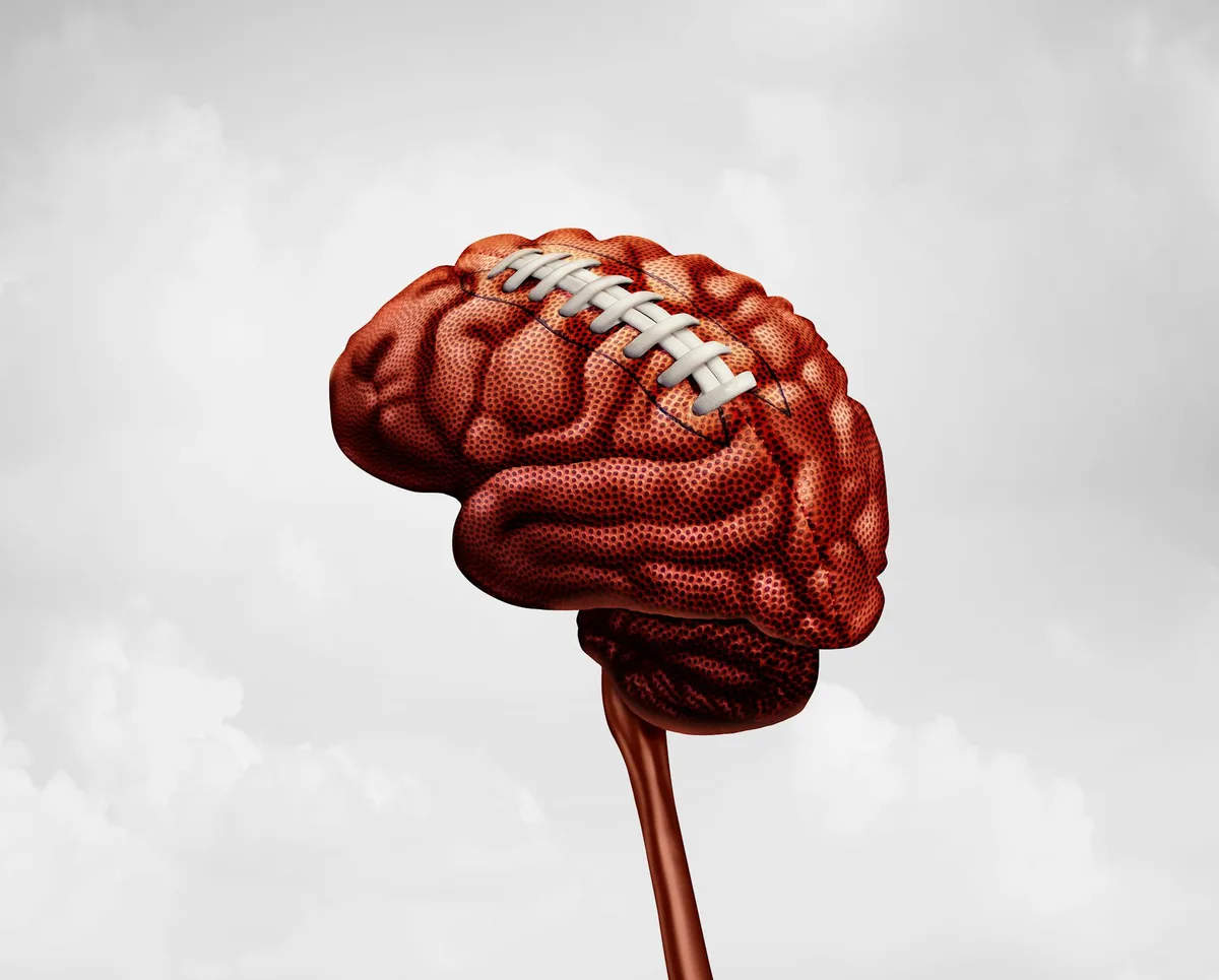 Sports leagues’ concussion guidelines must be broadened as brain health concerns rise