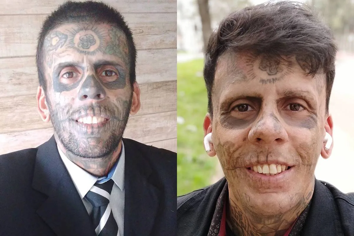 "Homem mais tatuado do Brasil" descobre tumor na bexiga