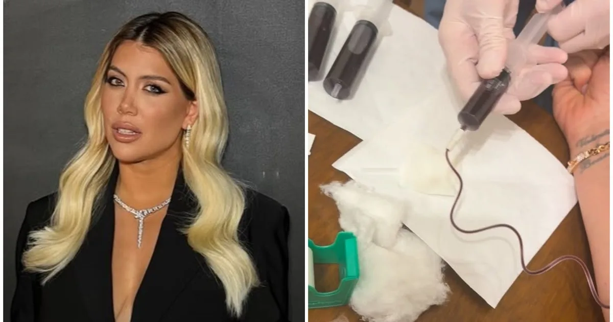Wanda Nara mostró la intimidad de sus controles médicos por la leucemia: “Hoy arranqué así”