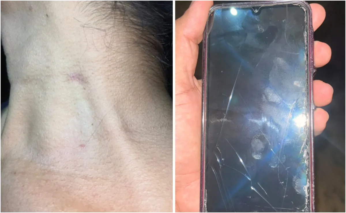 Homem descumpre medida protetiva e ataca mulher enquanto ela dormia em Rorainópolis