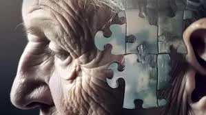 Estudo clínico busca pacientes em Curitiba para avaliar novos tratamentos de Alzheimer