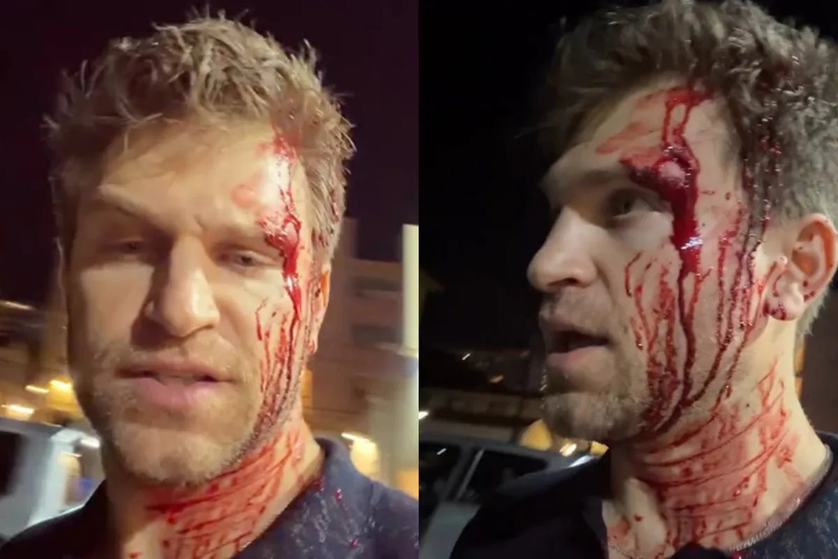 El violento robo a punta de pistola que sufrió Keegan Allen, protagonista de Pretty Little Liars: “Mi vida por un reloj”