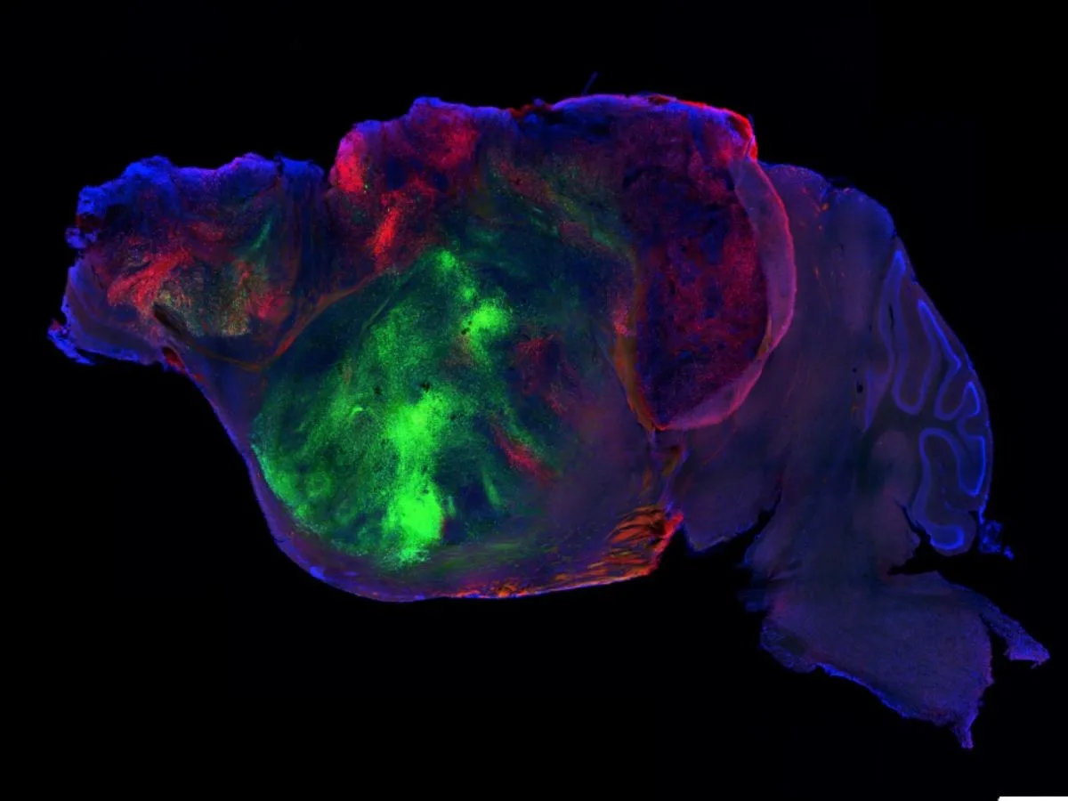 “Etudier les cellules neurales humaines à mesure qu'elles mûrissent”. Entretien avec le créateur des souris aux cerveaux humanisés
