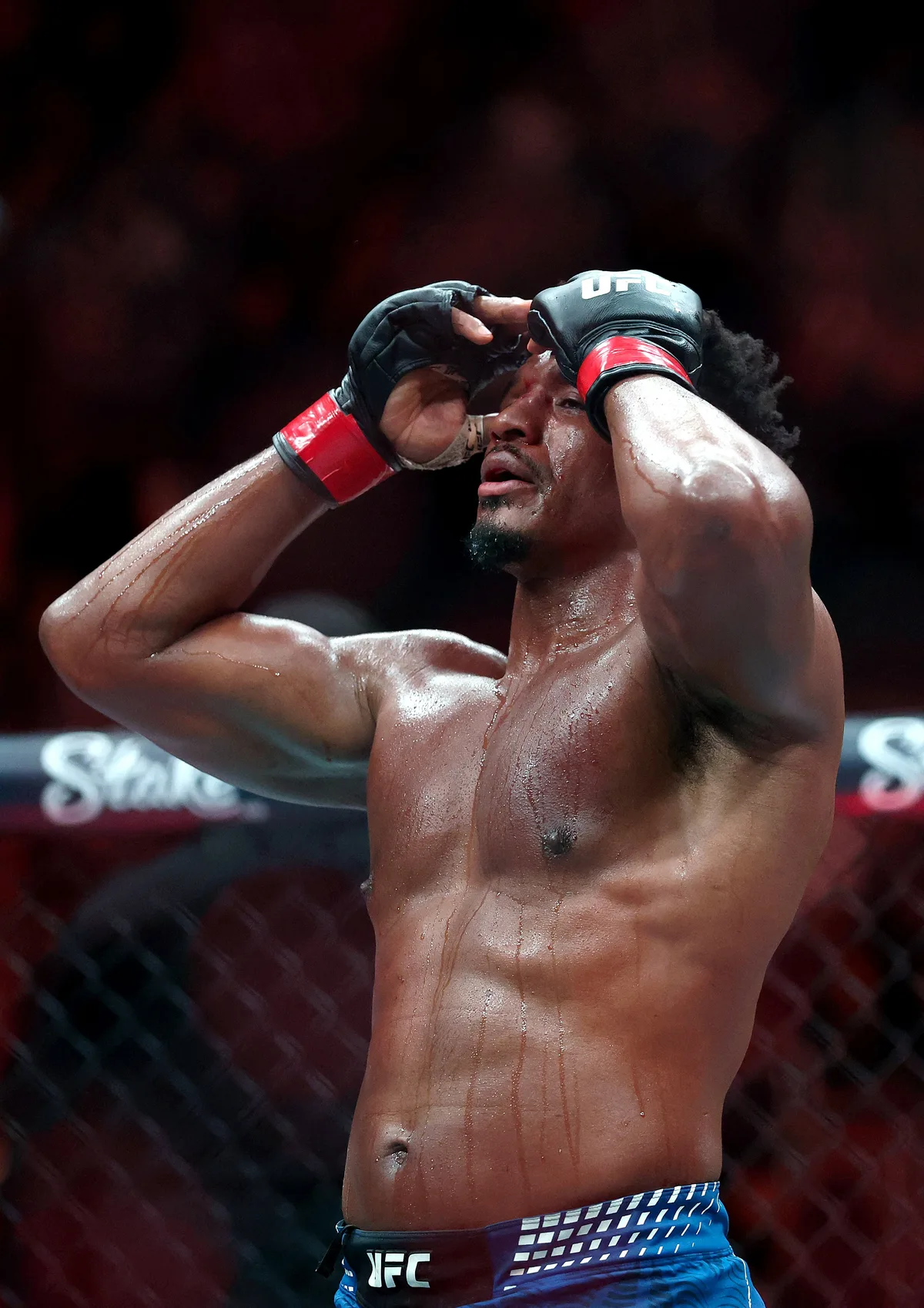 UFC 331: Lutador vence com fratura exposta no dedo; imagem é forte