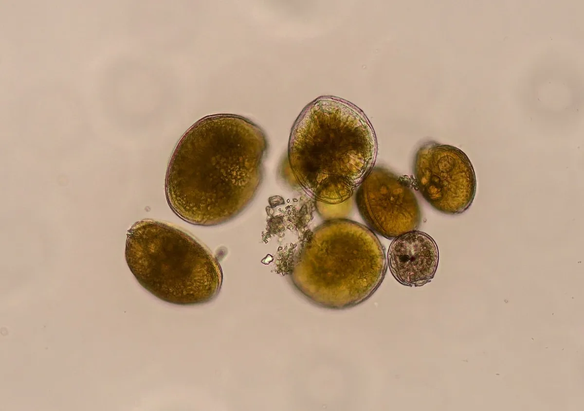 Científicos registran por primera vez en Cuba una microalga vinculada con toxinas de la ciguatera