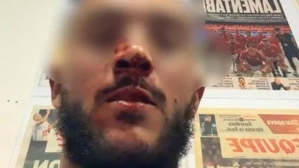 "Il était au sol, en train de se faire étrangler" : agressée avec son conjoint après un match de l'OL, une élue du Rhône témoigne des violences et des propos racistes