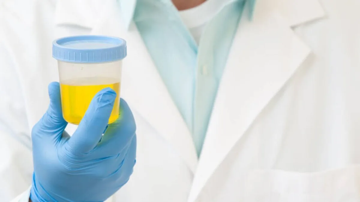 Scientists turn urine urea into hydrazine for rocket fuel and EV batteries