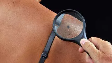 La peau scannée en "trois secondes" : pour pallier le manque de dermatologues, des centres de santé misent sur l'intelligence artificielle