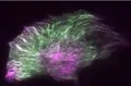 Paclitaxel provoca un cambio inesperado en células cancerosas que podría estar relacionado con resistencia al tratamient