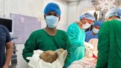 Doctors remove 3.1kg stone from man's bladder and claim record