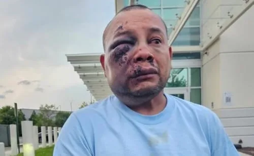 Mexicano detenido por ICE en Virginia despierta en hospital con golpes y un derrame en la cabeza; asegura que recibió una descarga eléctrica