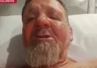 Paciente é acusado de atear fogo em homem em hospital de Sydney