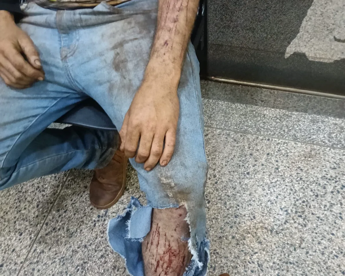 Jovem diz que foi atacado por onça enquanto trabalhava em colheitadeira