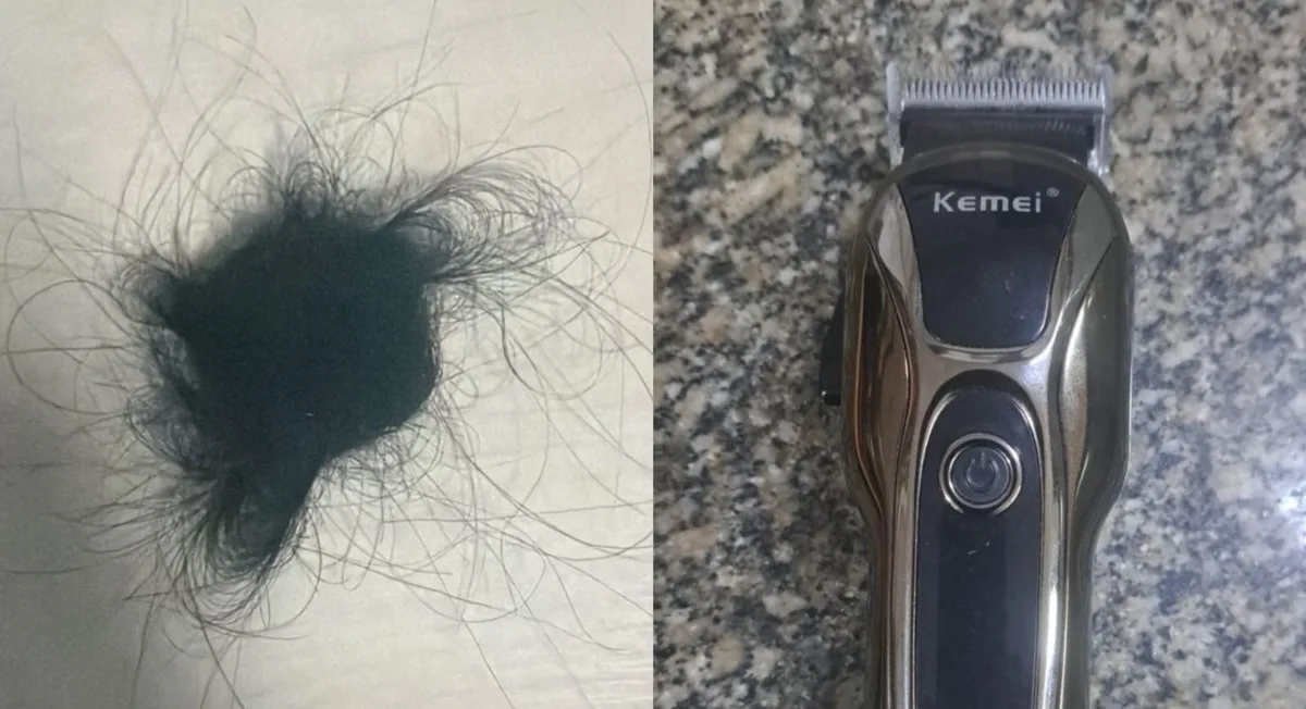 Jovem é agredida e tem cabelo raspado por grupo de mulheres após emboscada