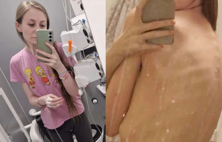 “하루에 백 번씩 토해, 체중 38kg”… 20대 여성의 안타까운 사연