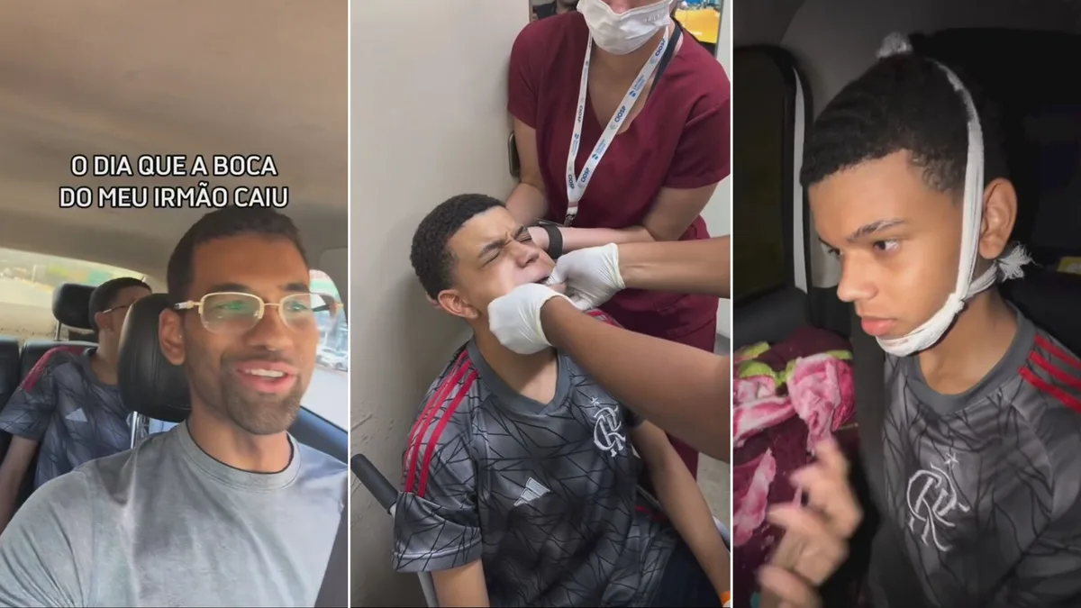Adolescente vai parar em hospital do DF após bocejar e mandíbula sair do lugar; veja VÍDEO