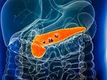 Daily pill DOUBLES pancreatic cancer survival - experts demand pioneering drug gets fast-track NHS approval