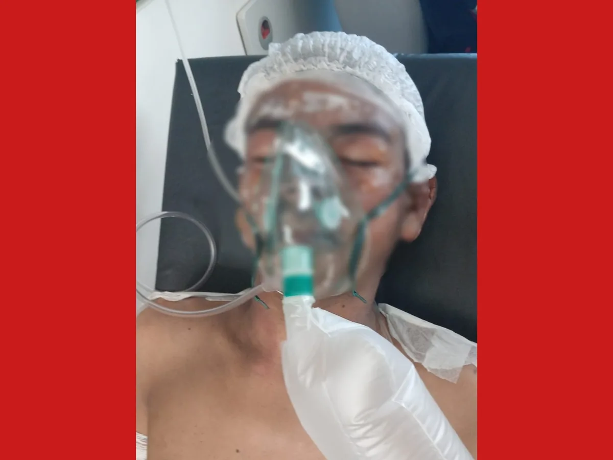 Adolescente que teve 40% do corpo queimado ao salvar irmãos em incêndio é transferido de hospital no AC