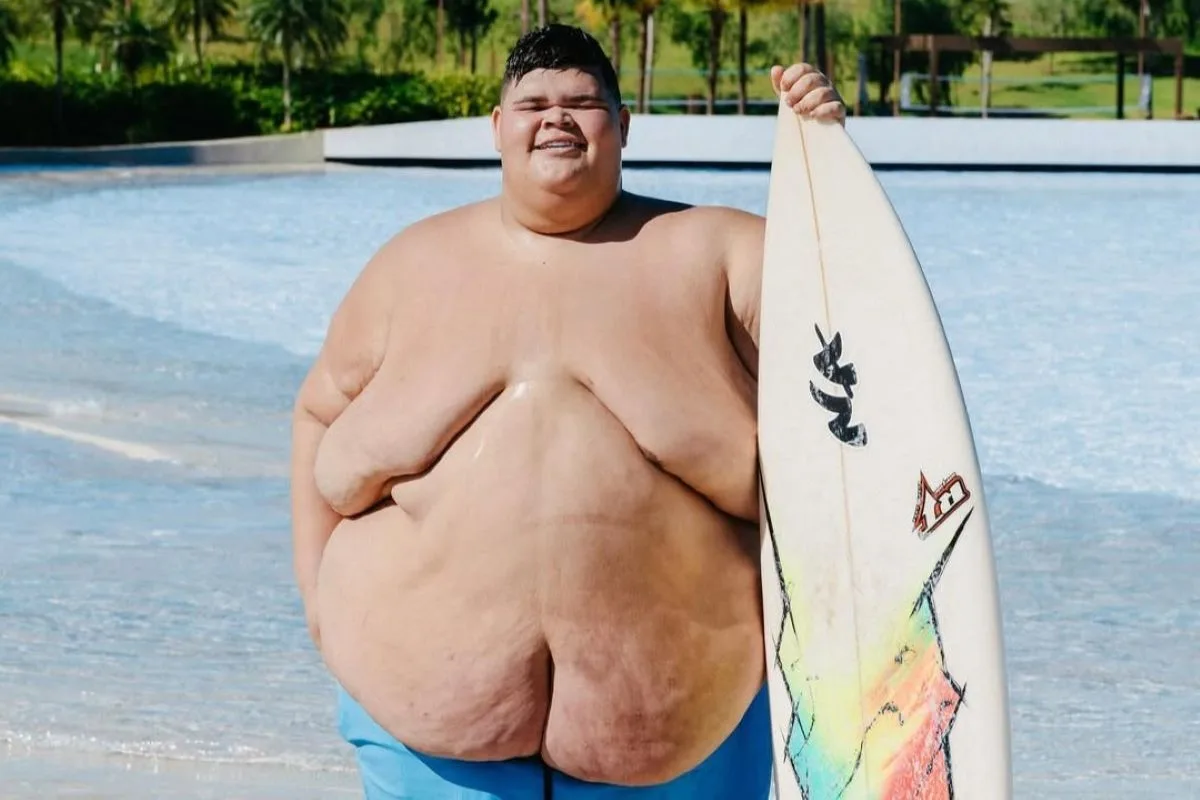 Após perder 130 kg, Gordão da XJ usa biquíni da noiva. Veja foto