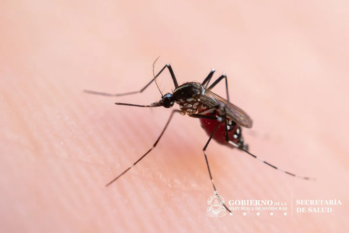 Honduras registra unos 8 mil casos de dengue y cuatro muertes confirmadas en 2026