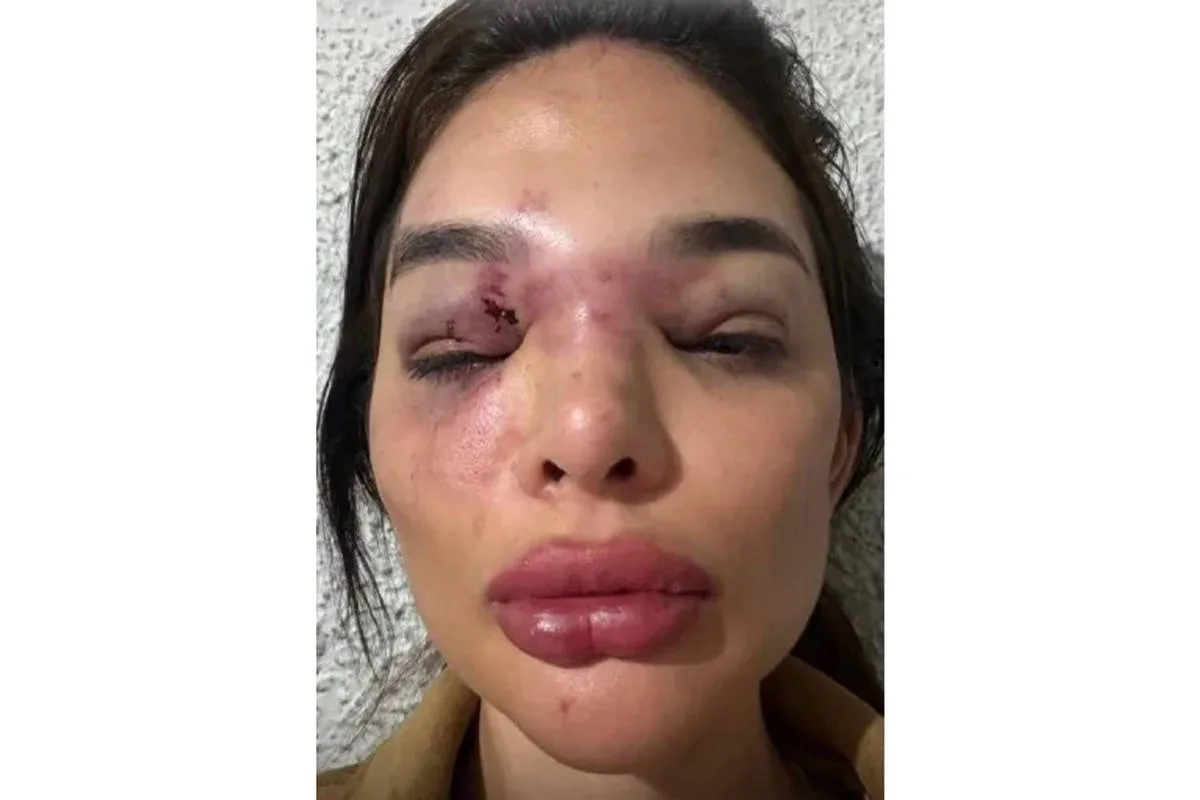 Empresário é preso por suspeita de agredir mulher com taco de beisebol em SP