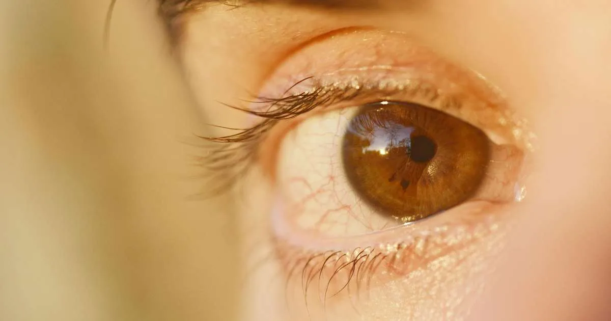 Anemia pode ser detectada pelos olhos com nova tecnologia; entenda